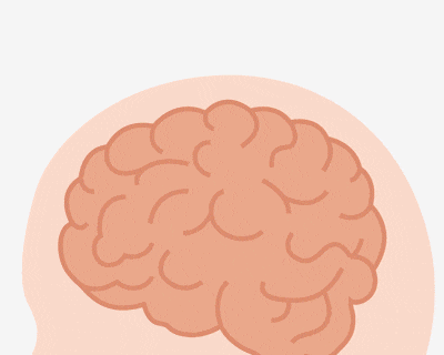 アルツハイマー発生の仕組みアニメ